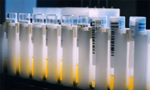 LIMS in Manufacturing: All You Need to Know!